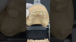 Prótesis removible de acrílico transparente #odontologia #dentista #dientes