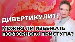 Дивертикулит: можно ли избежать повторного приступа?