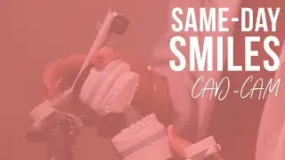 Same-Day Smiles (CAD-CAM)