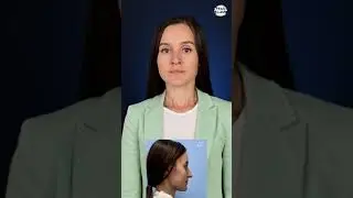 Отзыв. Риносептопластика. Доктор - Абрамян Соломон Маисович.
