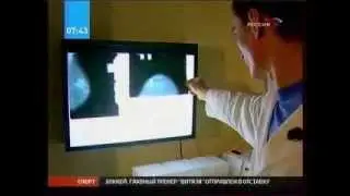 Маммография. Метод диагностики молочных желез