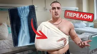 КАК ЖИТЬ С ОДНОЙ РУКОЙ? Я В БОЛЬНИЦЕ!