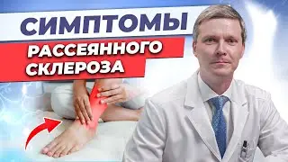 Как проявляется РС? Симптомы рассеянного склероза