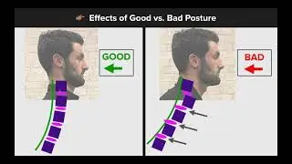 The Big 2 Causes Of Neck Pain, Shoulder Pain, and Headaches [Due To Poor Posture] [Wyckoff, NJ]