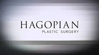 Patient Testimonial - Hagopian Plastic Surgery