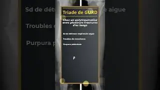 Triade de Gurd chez un polytraumatisé