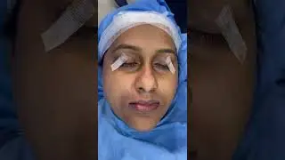 Long face, concave face, underbite correction by Jaw Surgery - Best Maxillofacial Surgery in India