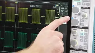 5 Series B MSO Intuitive Controls