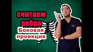 Как считать ребра на рентгенограмме? БОКОВАЯ ПРОЕКЦИЯ | Рентгенология