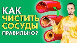 Как чистить сосуды правильно? Чистка сосудов!