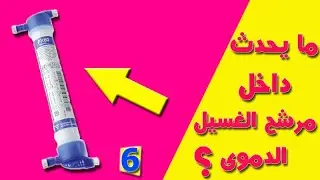 الحلقة (6) | Hemodialysis | مرشح الغسيل الكلوي Dialyzer | الجزء 1
