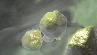 Colecistectomía (extirpación de la vesícula biliar)