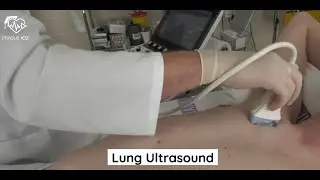 Lung ultrasound