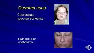 ПВБ. Общий осмотр.