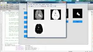 Digital Image Processing Mini Projects | Digital Image Processing Mini Thesis