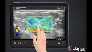 NOVO LANÇAMENTO | Ultrassom de Bolso - Linha Clarius