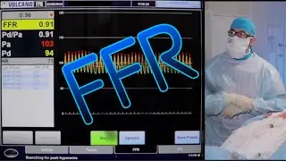 FFR. В операционной Philips