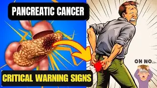 10 Symptoms of PANCREATIC CANCER That Will SHOCK YOU | Critical Warning Signs
