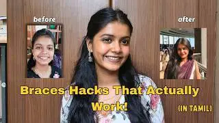 Best Braces Hacks for Pain Relief, Eating & Cleaning (Must Watch!) in TAMIL 