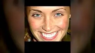Anahi Realmente sem Make E Com Anorexia!