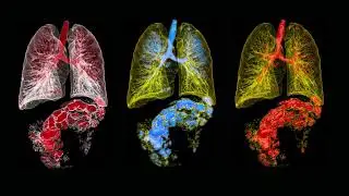 Medical imaging, ct reconstruction