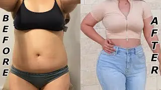 MY SURGERY RESULTS!!! | BBL REVEAL 🤪🍑
