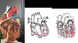 3D to 2D Heart Myocardium 1080