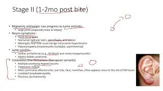 Lyme Disease Explained