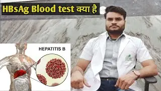 HBsAG Blood test (in hindi) |hepatitis B virus| hepatitis B surface antigens #mbbs #paramedical #lab