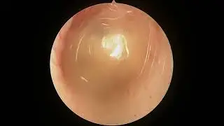 Отоскопия кота (Гнойный отит) / Otoscopy cat