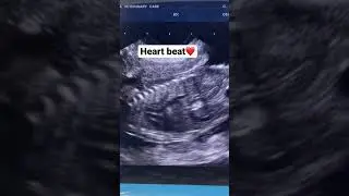 Drop a 👍 if u see heart beat ❤️ #trending #viral #dog #trendingshorts #video #pets #shorts #love