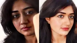 Best Fairness Cream in India Review, Amazing Results!