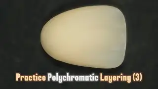 Polychromatic Dental Composite Layering Practice - Exercise 3