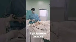 Шунтирование желудка. Операция на сахарный диабет в Казахстане. Хирург Никонов.