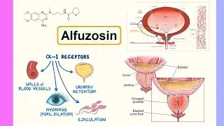 alfuzosin