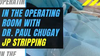 Dr. Paul Chugay Demonstrates JP Stripping Technique (English)