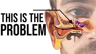 Why you can't hear Japanese pitch accent