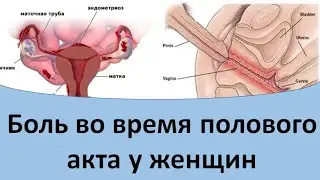 Боль во время полового акта у женщин. Боль во время секса.
