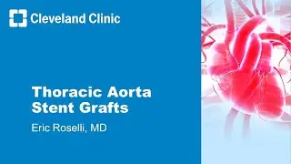 Thoracic Aorta Stent Grafts