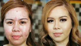 How to Cover Acne with Makeup. (Acne Prone) #makeupartist