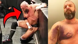 WWE Superstars who continued a match whilst 1njured