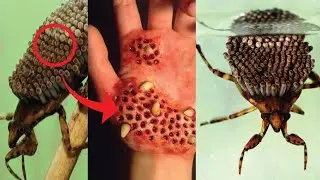 Are YOU Ever Afraid of BUGS ....! Top 10 Most Dangerous and Deadliest Insects | Top Deadliest Bugs