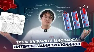 Типы инфаркта миокарда. Интерпретация тропонина
