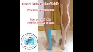 Kinesio Taping Tendine d'Achille. Post rottura e Tendinite. Tape yourself Achilles Tendon rupture