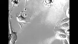 Migrating neuronal cells