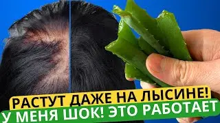 Волосы растут за 10 часов длинными и больше не выпадают, рабочее средство от облысения!