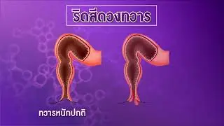 RIDJI โรคริดสีดวงทวาร ให้ริดจิดูแลคุณ