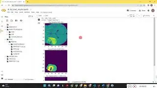 3D-Unet model for Brain tumor segmentation  - Brats Dataset -Python