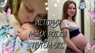 🩵МОЯ ИСТОРИЯ РОДОВ! КЕСАРЕВО СЕЧЕНИЕ.🩵