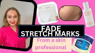 BEST PRODUCTS FOR STRETCH MARKS FROM A SKIN PROFESSIONAL!